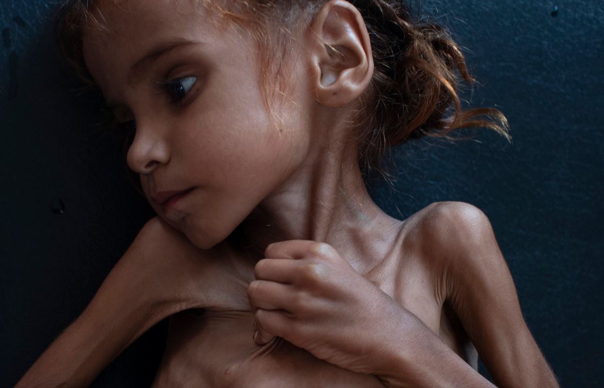 κορίτσι, Υεμένη