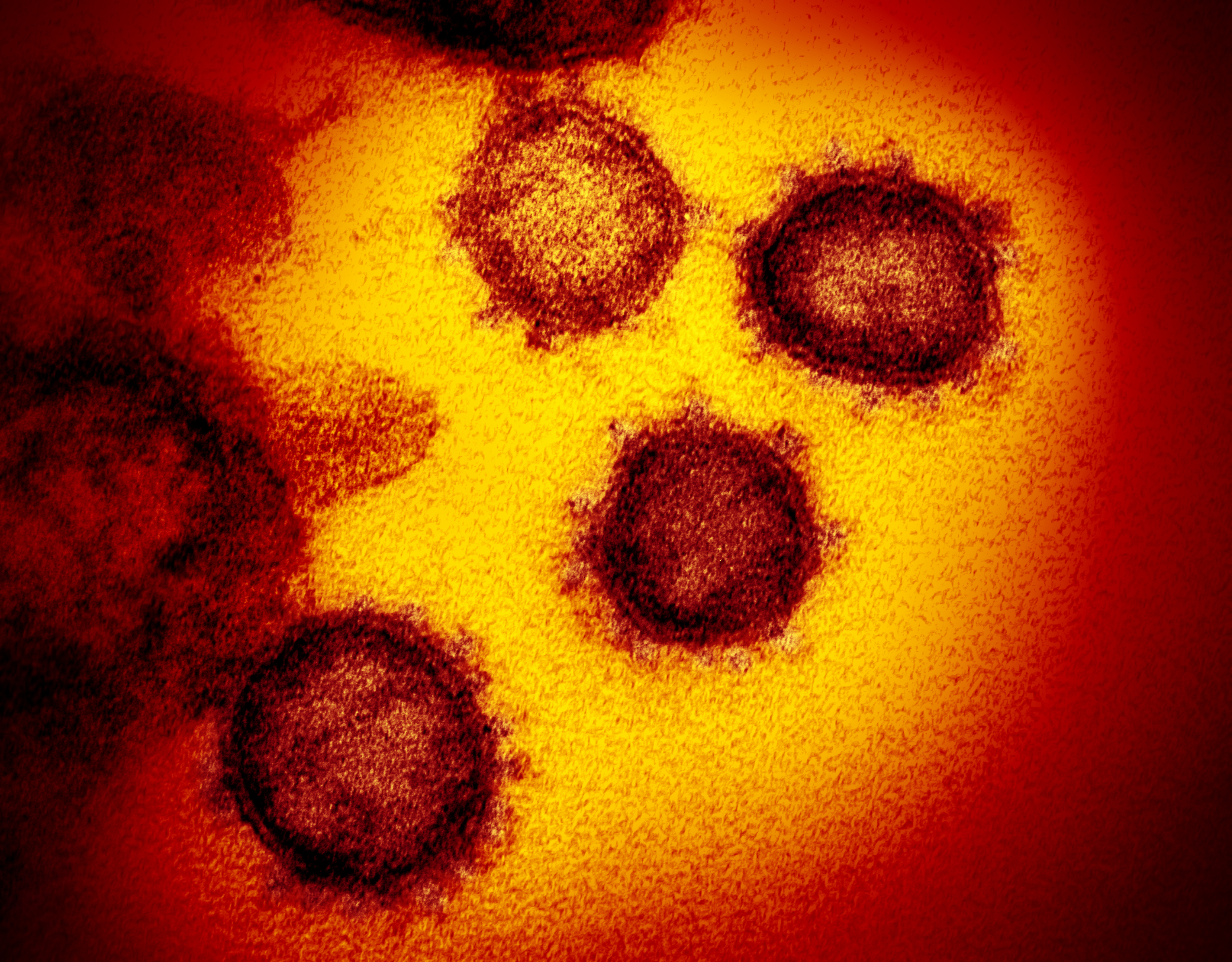 novel-coronavirus-sars-cov-2_49530315718_o.jpg