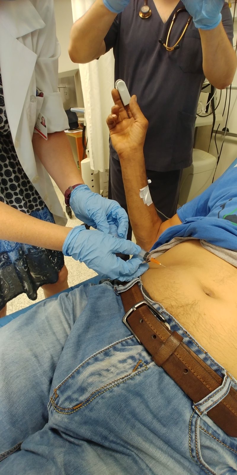 image_6483441_5.jpg Θεσσαλονίκη: Στο Ιπποκράτειο η πρώτη ελπιδοφόρα θεραπεία για την ηπατήτιδα Δ στη χώρα