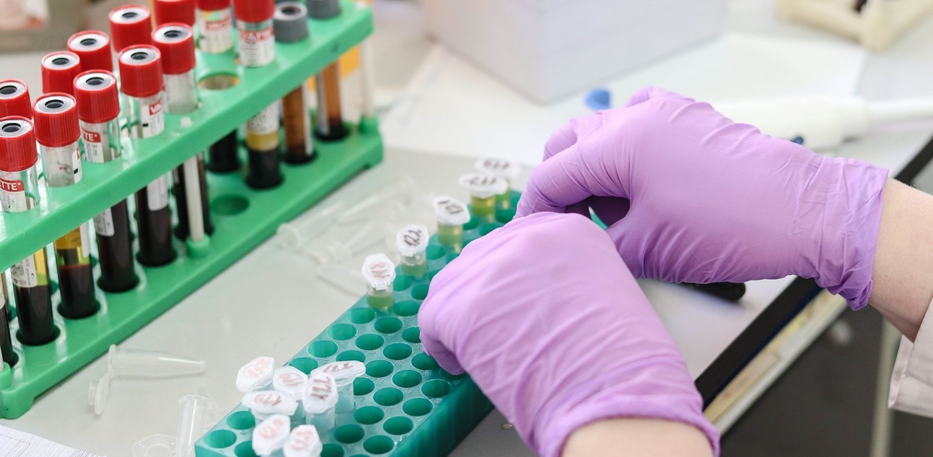 Ανώνυμες και γρήγορες εξετάσεις για τον ιό HIV/AIDS σε εξειδικευμένα κέντρα