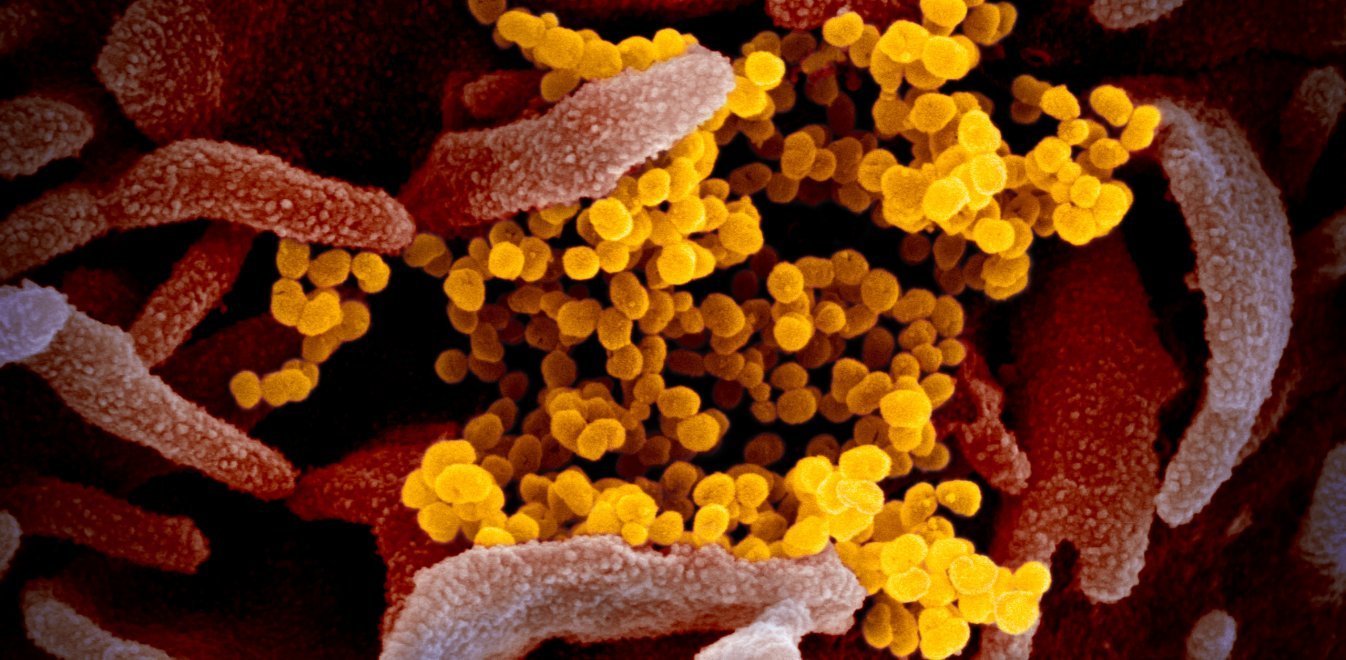 Ετσι είναι ο κοροναϊός - Το Ινστιτούτο Νοσημάτων των ΗΠΑ δημοσιεύει φωτογραφίες