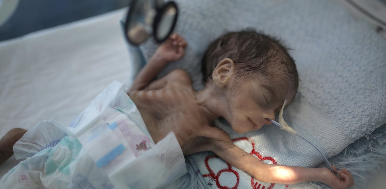 Unicef: Εκατομμύρια παιδιά οδηγούνται σε λιμοκτονία στην Υεμένη - Έκκληση για βοήθεια